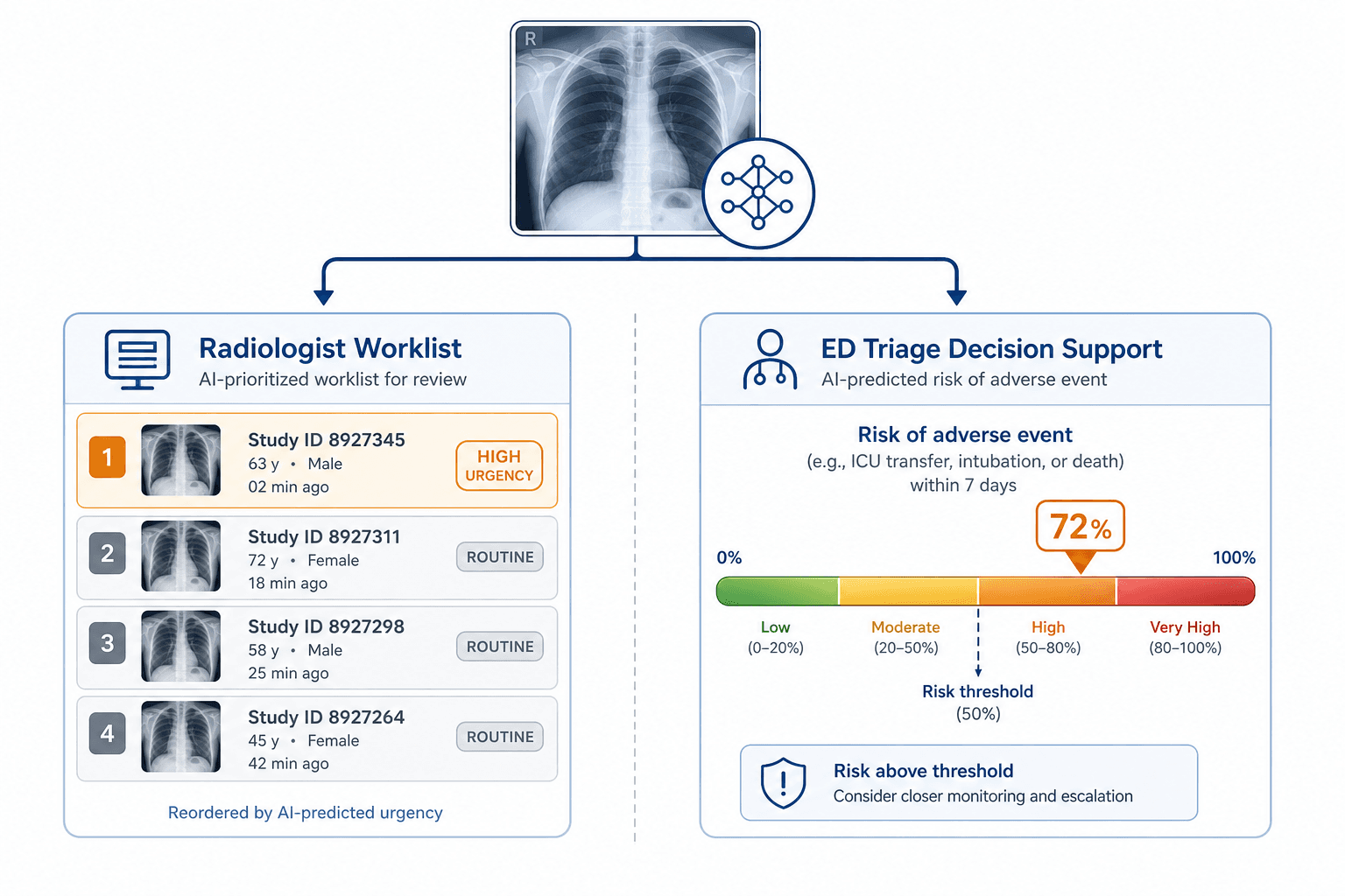 Diagram showing two parallel pathways from a central chest X-ray AI icon: left branch leads to a worklist prioritization panel, right branch leads to an adverse event risk gauge for ED clinical decision support.